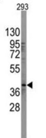Transcription Factor SOX-2 (SOX2) Antibody