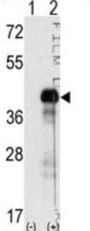 Transcription Factor SOX-2 (SOX2) Antibody