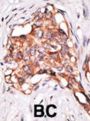GDF3 Antibody