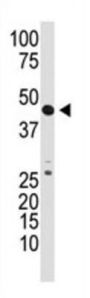 GDF3 Antibody
