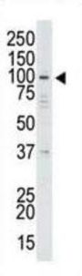 Ubiquitin Carboxyl-Terminal Hydrolase 13 (USP13) Antibody