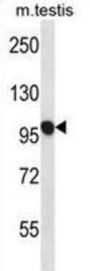 Ubiquitin Carboxyl-Terminal Hydrolase 20 (USP20) Antibody