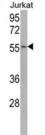 Ubiquitin Specific Peptidase 22 (USP22) Antibody