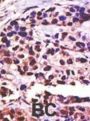 Ubiquitin Carboxyl-Terminal Hydrolase 25 (USP25) Antibody