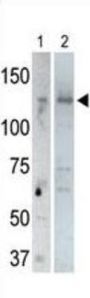 Ubiquitin Carboxyl-Terminal Hydrolase 25 (USP25) Antibody