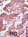 TOLLIP Antibody