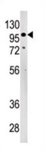 LLGL2 Antibody