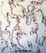 Advanced Glycosylation End Product-Specific Receptor (AGER) Antibody