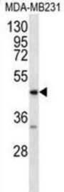 Advanced Glycosylation End Product-Specific Receptor (AGER) Antibody