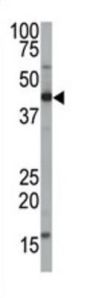 Farnesyltransferase Alpha (FNTA) Antibody