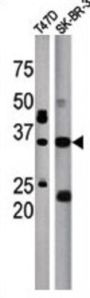 ICMT Antibody