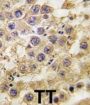 Nanos C2HC-Type Zinc Finger 2 (NANOS2) Antibody