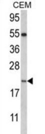 Nanos C2HC-Type Zinc Finger 2 (NANOS2) Antibody