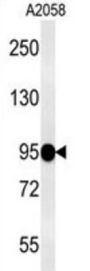 SEMA6A Antibody