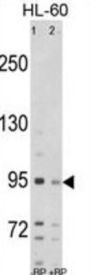 SEMA6A Antibody