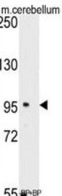 SEMA6A Antibody