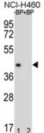 Myelin Basic Protein (MBP) Antibody