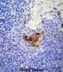 Melanoma Cell Adhesion Molecule (MCAM) Antibody
