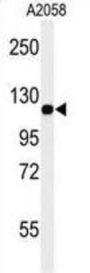 Melanoma Cell Adhesion Molecule (MCAM) Antibody