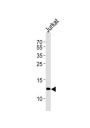 Beta-2-Microglobulin (B2M) Antibody
