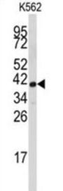 Fibrillarin (FBL) Antibody