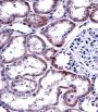 Hepatocyte Nuclear Factor 4 Alpha (HNF4A) Antibody