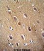 Gamma-Enolase (ENO2) Antibody