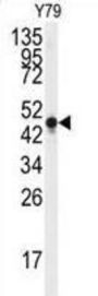 Gamma-Enolase (ENO2) Antibody