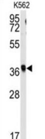 Replication Factor C Subunit 2 (RFC2) Antibody