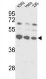 Lupus La Protein (SSB) Antibody