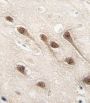 Runt Related Transcription Factor (RUNX1) Antibody