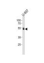 Runt Related Transcription Factor (RUNX1) Antibody