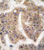 E3 Ubiquitin-Protein Ligase TRAIP (TRAIP) Antibody