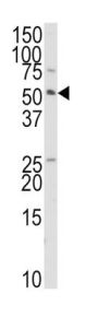 E3 Ubiquitin-Protein Ligase TRAIP (TRAIP) Antibody