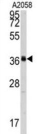 RNA Polymerase I Subunit C (POLR1C) Antibody