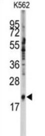Small Nuclear Ribonucleoprotein Polypeptide C (SNRPC) Antibody