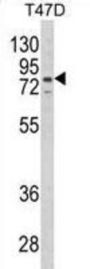 Leukotriene A-4 Hydrolase (LTA4H) Antibody
