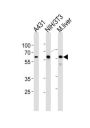 Heat Shock 60 kDa Protein 1, Chaperonin / HSP60 (HSPD1) Antibody