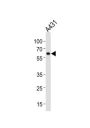 Heat Shock 60 kDa Protein 1, Chaperonin / HSP60 (HSPD1) Antibody