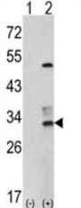 Capping Protein (Actin Filament) Muscle Z-Line, Beta (CAPZB) Antibody