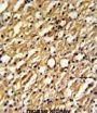 Dimethylarginine Dimethylaminohydrolase 1 (DDAH1) Antibody