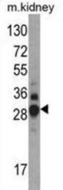 Dimethylarginine Dimethylaminohydrolase 1 (DDAH1) Antibody