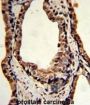 Triosephosphate Isomerase (TPI1) Antibody