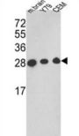 Triosephosphate Isomerase (TPI1) Antibody