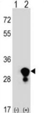 Triosephosphate Isomerase (TPI1) Antibody