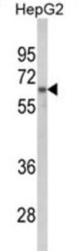 Heterogeneous Nuclear Ribonucleoprotein L (HNRPL) Antibody