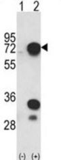 Heterogeneous Nuclear Ribonucleoprotein L (HNRPL) Antibody