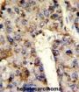 Heterogeneous Nuclear Ribonucleoprotein L (HNRPL) Antibody