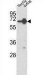 Heterogeneous Nuclear Ribonucleoprotein L (HNRPL) Antibody