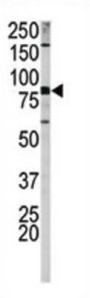 Amyloid-beta Precursor Protein Phospho-Ser730 (APP pS730) Antibody